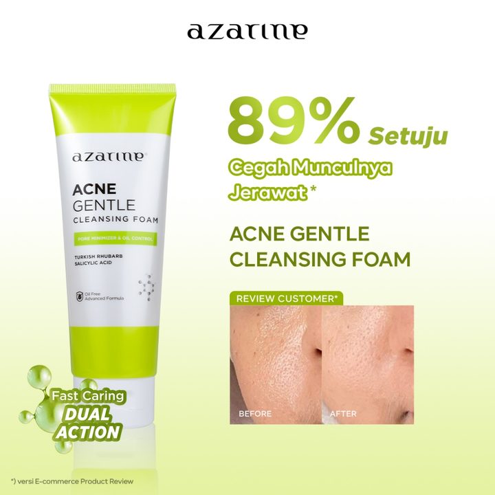 Azarine Acne Gentle Cleansing Foam